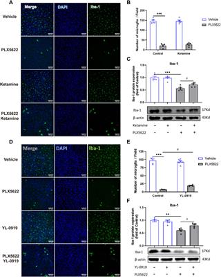 Essential role of microglia in the fast antidepressant action of ketamine and hypidone hydrochloride (YL-0919)
